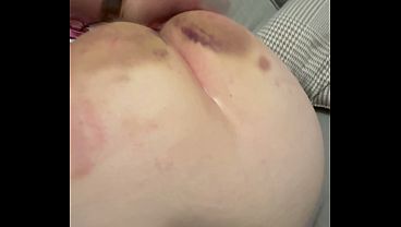 Esame intimo: la troia si mostra per il dottore